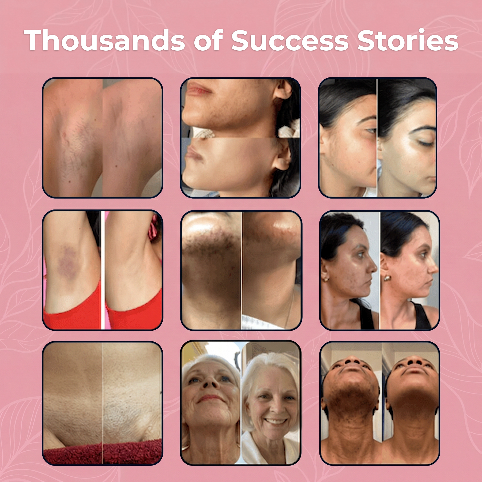 Hairora™ Hair Removal Body Drops